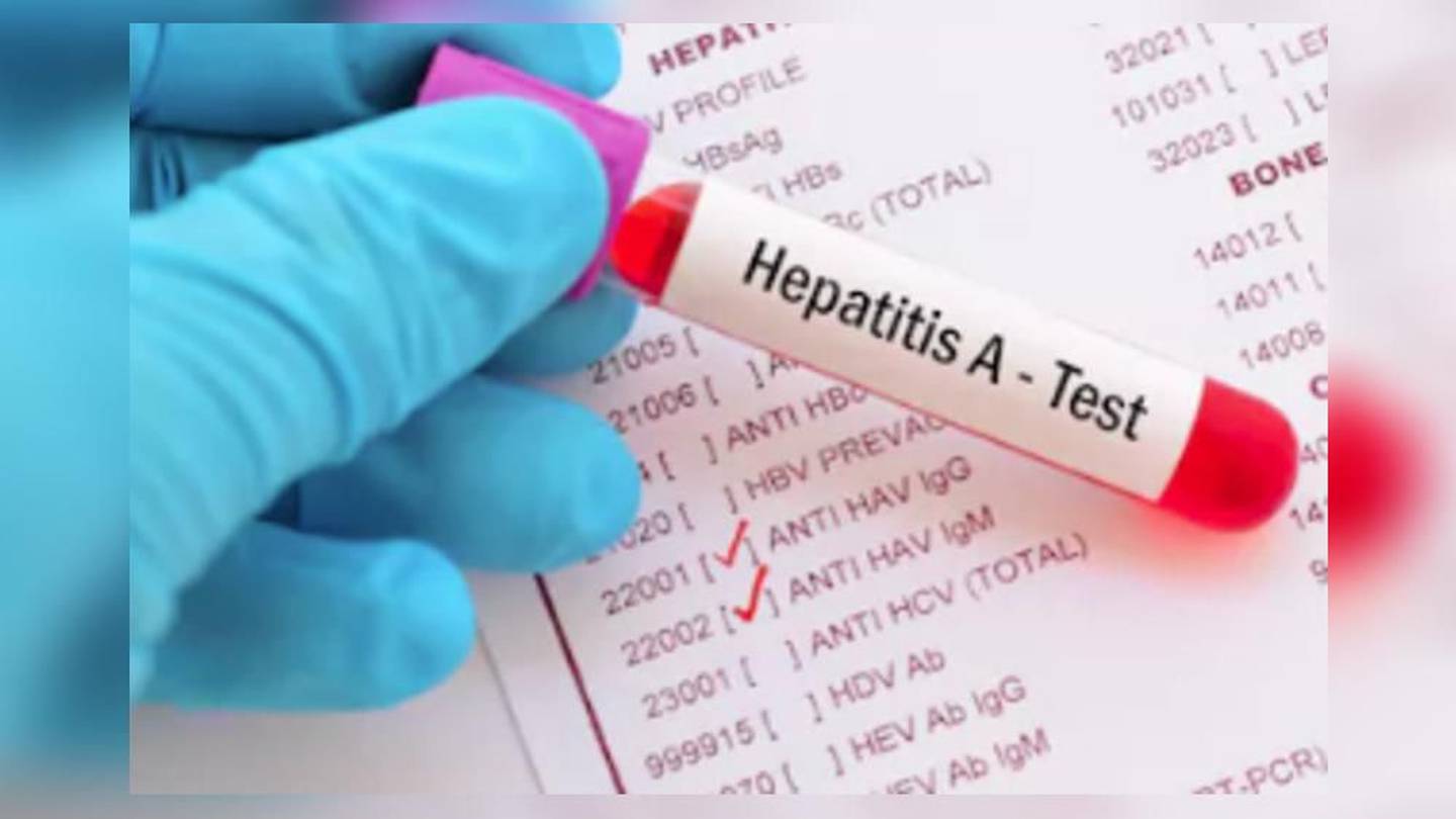 Bei einem Restaurantmitarbeiter in Gwinnett wurde Hepatitis A diagnostiziert, Kunden waren möglicherweise exponiert – WSB-TV Channel 2