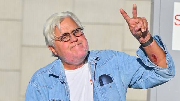 Jay Leno returns to stage two weeks after sustaining burns