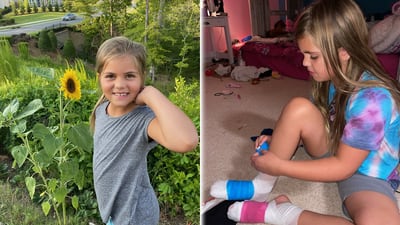 Mom says 8-year-old daughter’s COVID-19 side effects include loss of toenails