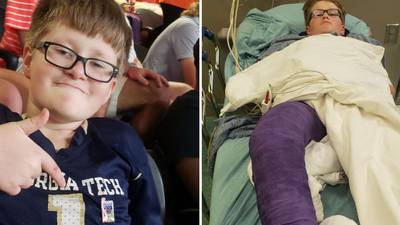 11-year-old boy hospitalized after dad says he was hit by car near Mercedes-Benz Stadium