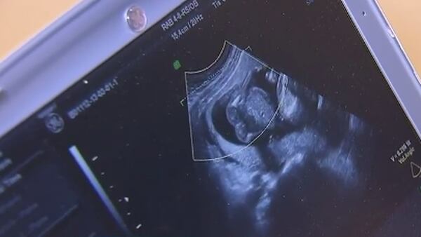 The abortion battle: GA Republicans say more needs to be done while Dems want a ballot measure