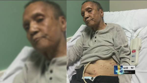 Woman says father was bitten 100+ times by ants before death at VA Medical Center
