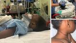 5-year-old Atlanta girl in ICU after freak summer camp accident involving slide, jump rope