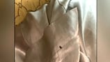 Residents at local senior living complex complain of bed bugs biting at them