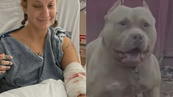Dog sitter says pit bull she took for a walk in metro Atlanta tried tearing off her arm