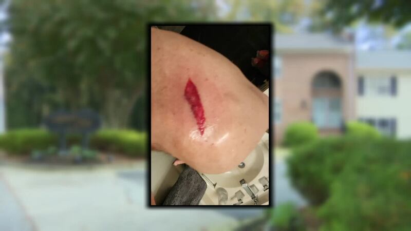 Buckhead man shot by stray bullet while watching movie on his computer