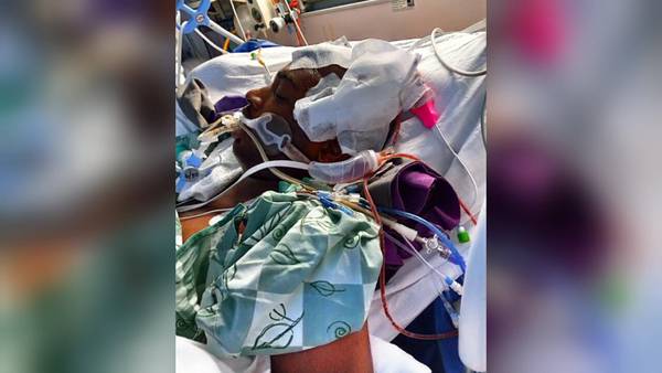 Teen hit after a DUI crash has mom asking for prayers and change